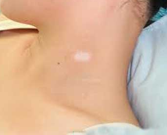 长春博润皮肤病医院